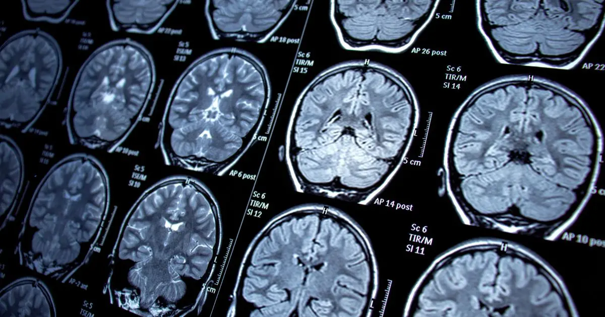 Analiza companiilor de imagistica prin rezonanta magnetica pana in 2031